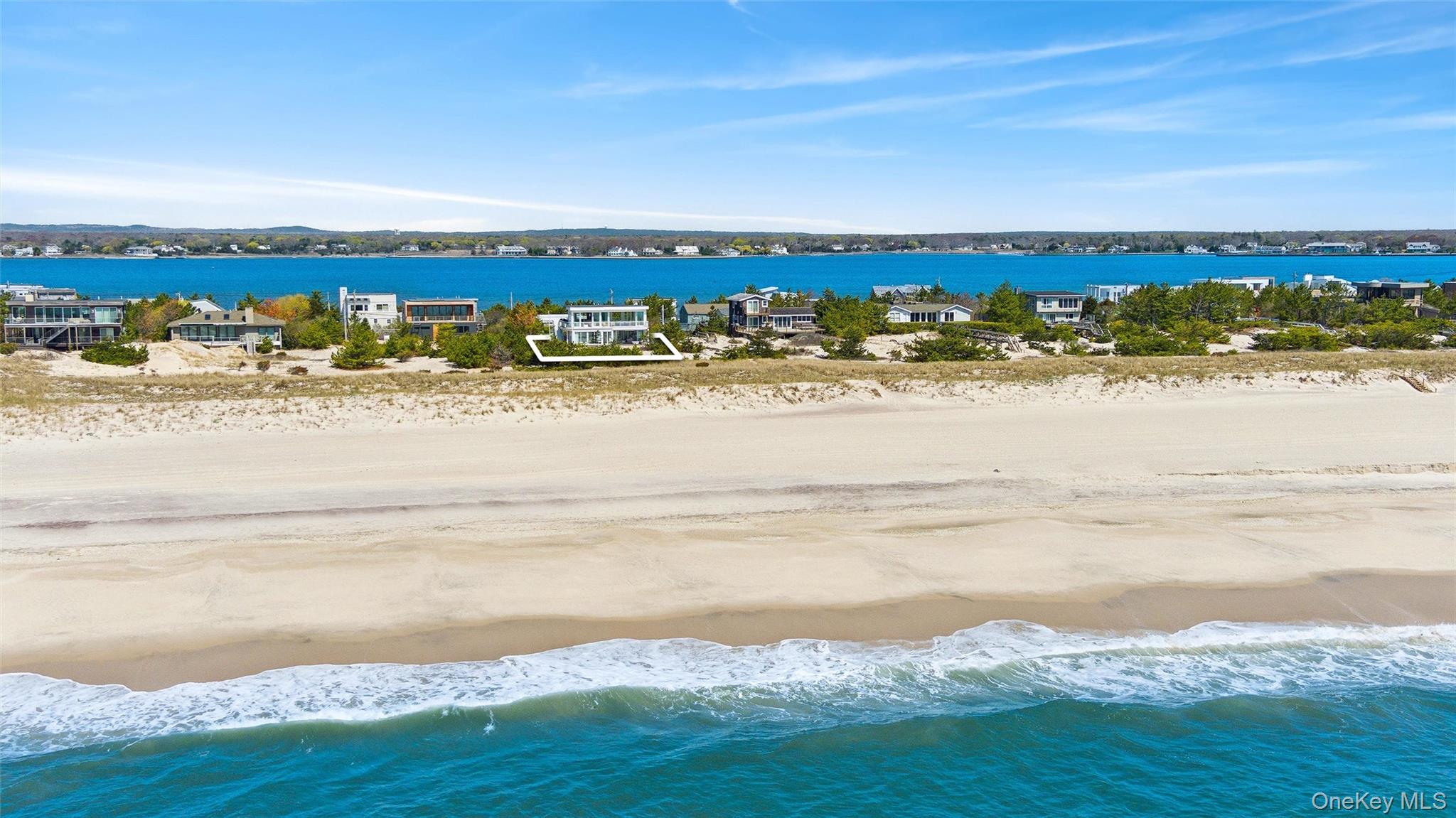 413B Dune Road – For Rent photo 26