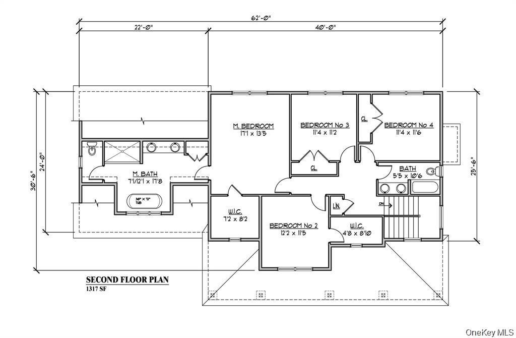 17 Sunset Lane – For Sale photo 50