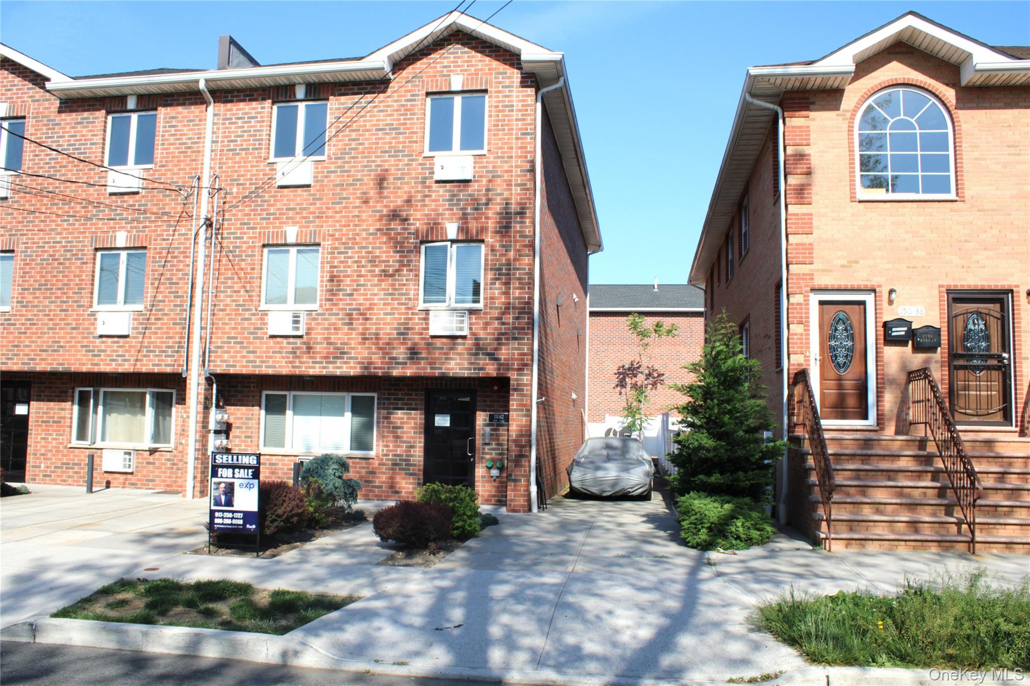 150-42 99th Place – For Sale photo 2