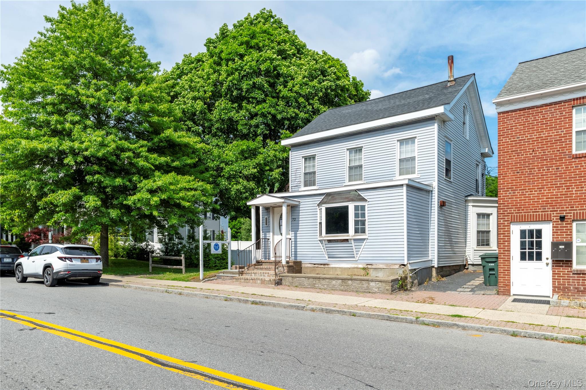 72 Gleneida Avenue – For Sale photo 3