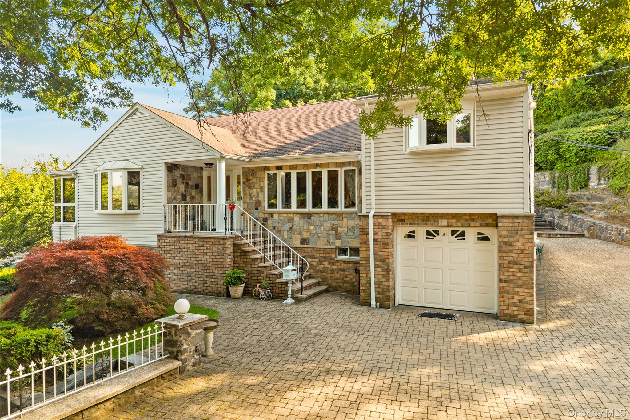 81 Avondale Road – For Sale photo 4