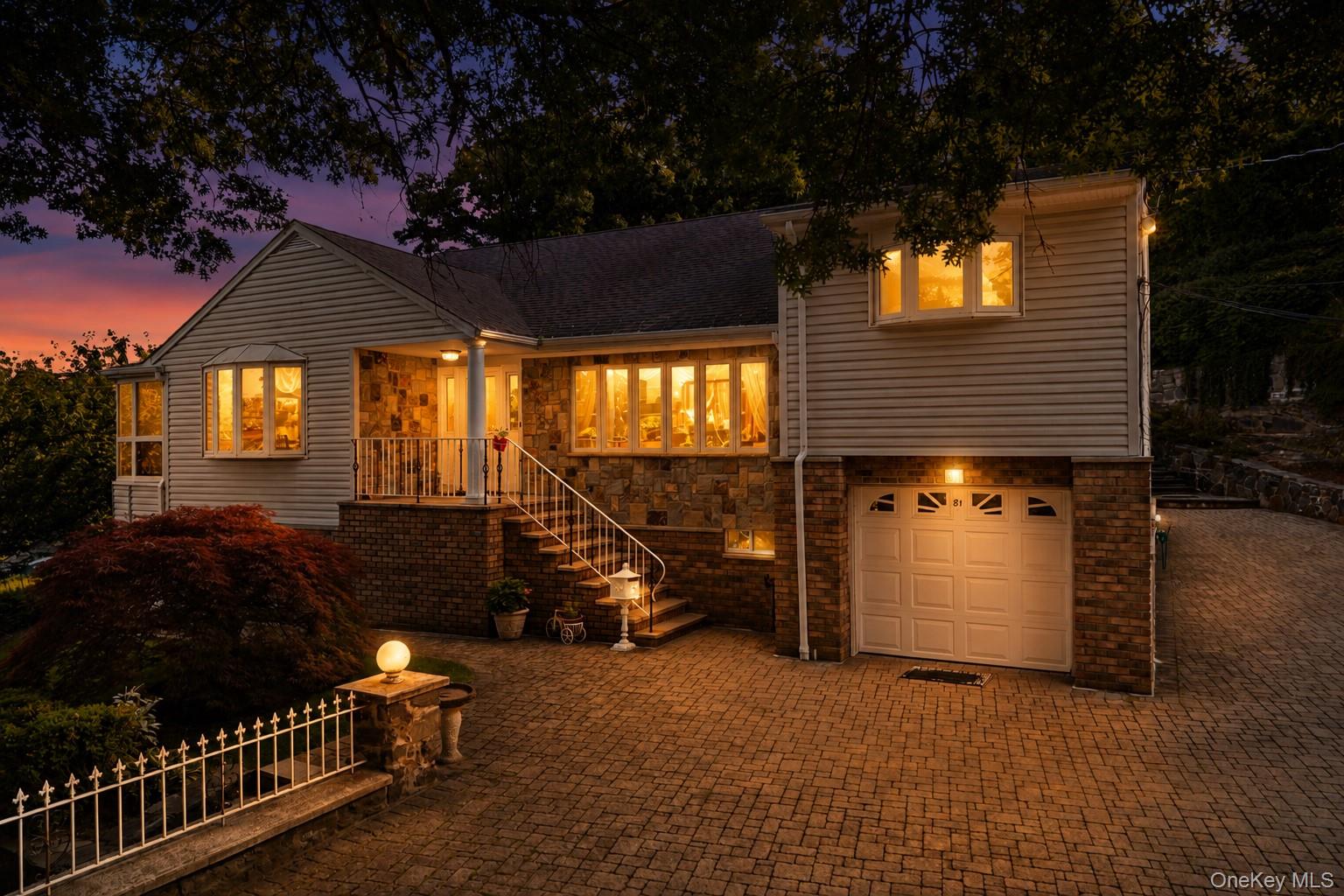 81 Avondale Road – For Sale photo 3
