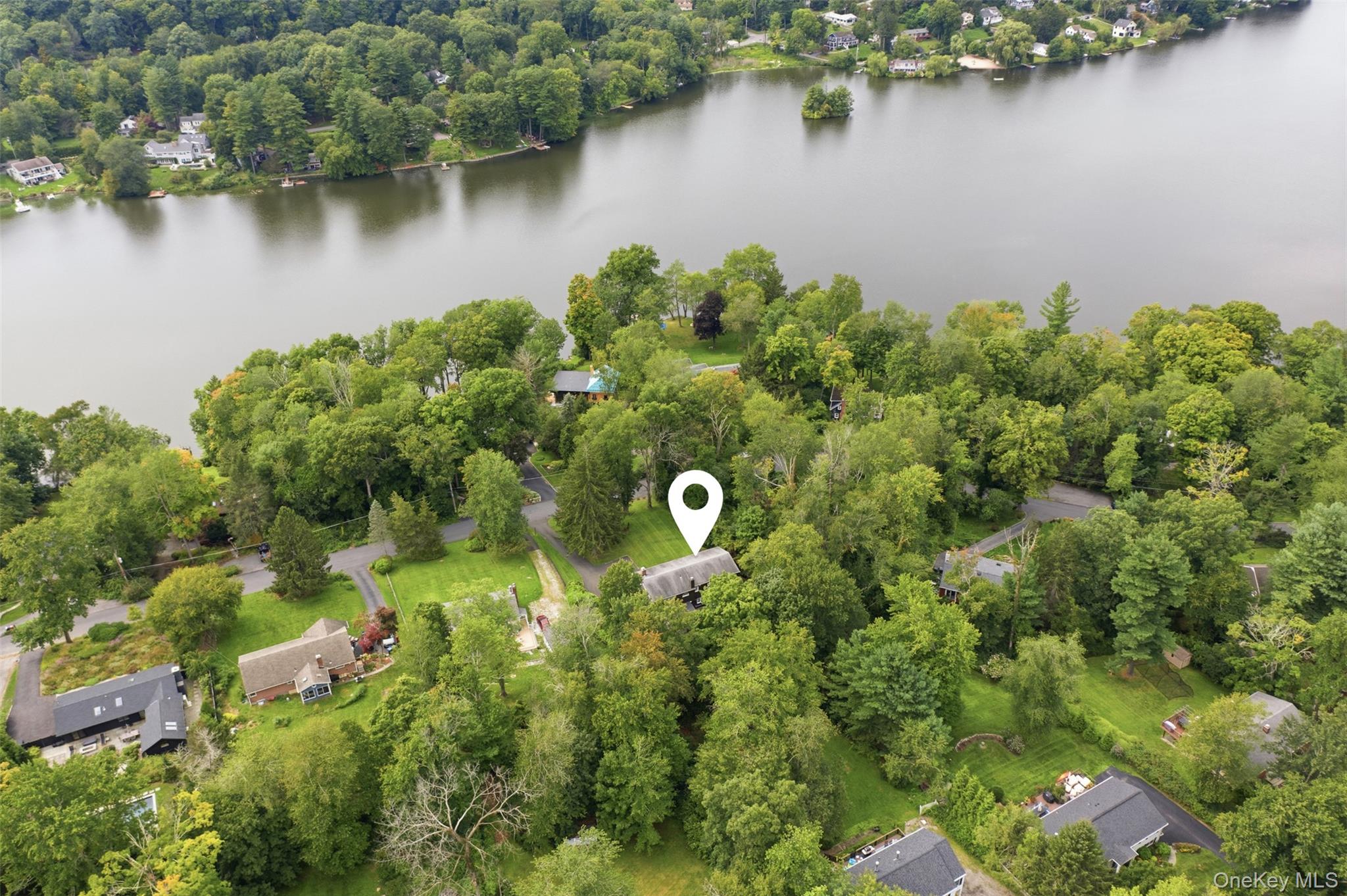 46 Truesdale Lake Drive – For Sale photo 46