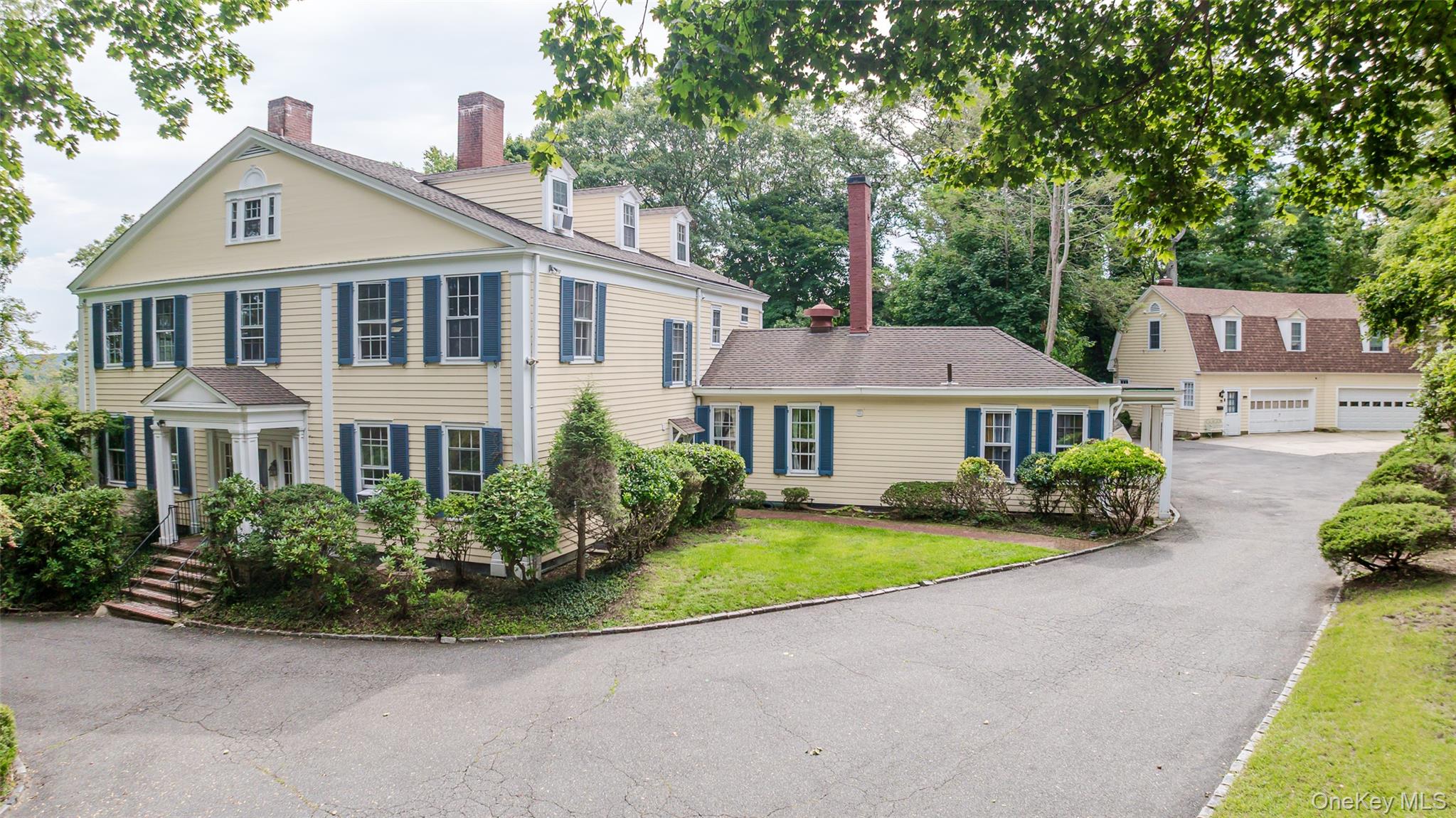 51 Lake Avenue – For Sale photo 4