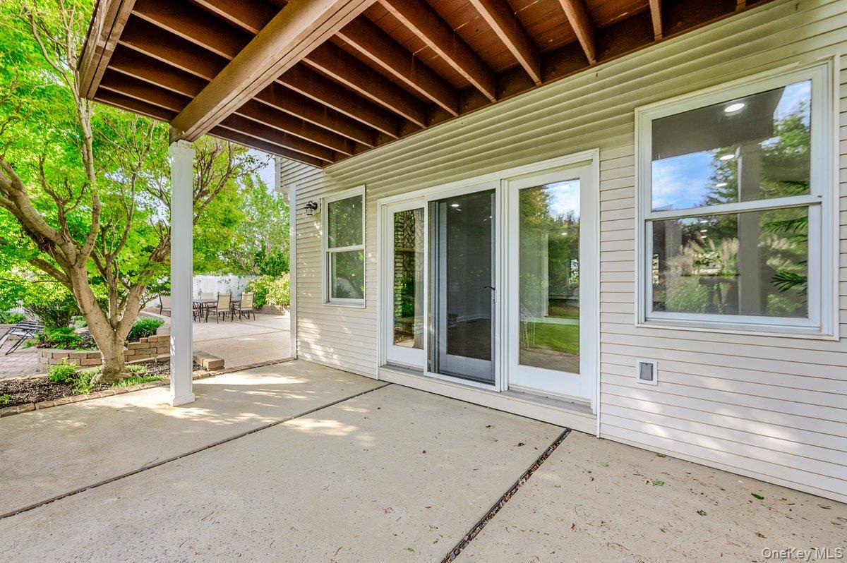 139 Coronado Street – For Sale photo 39