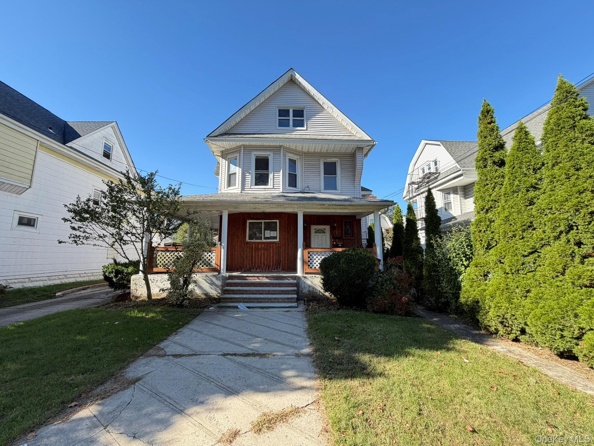 8658 110th Street – For Sale